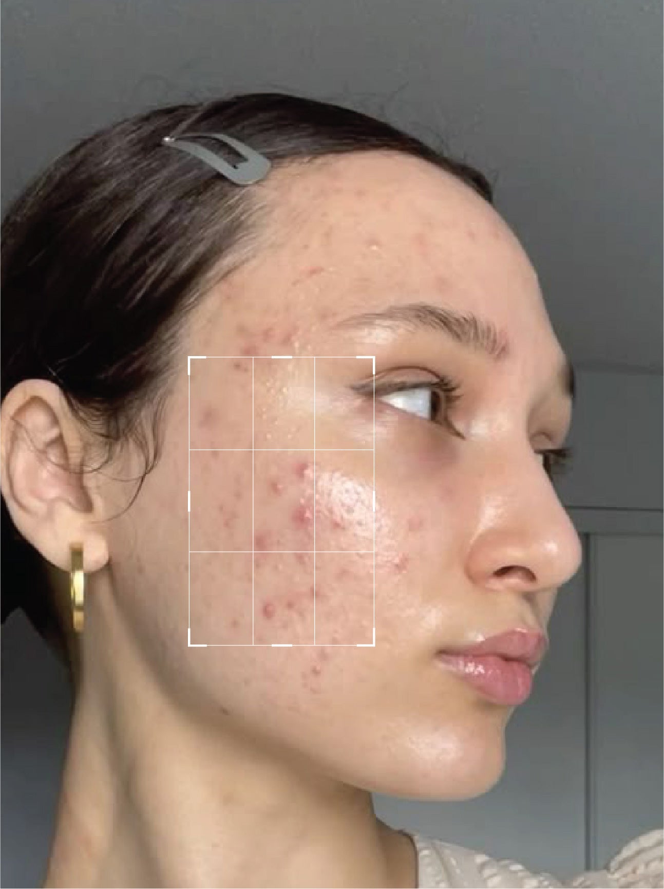 Oil Control Facewash – With Tea Tree Oil & 2% Salicylic Acid